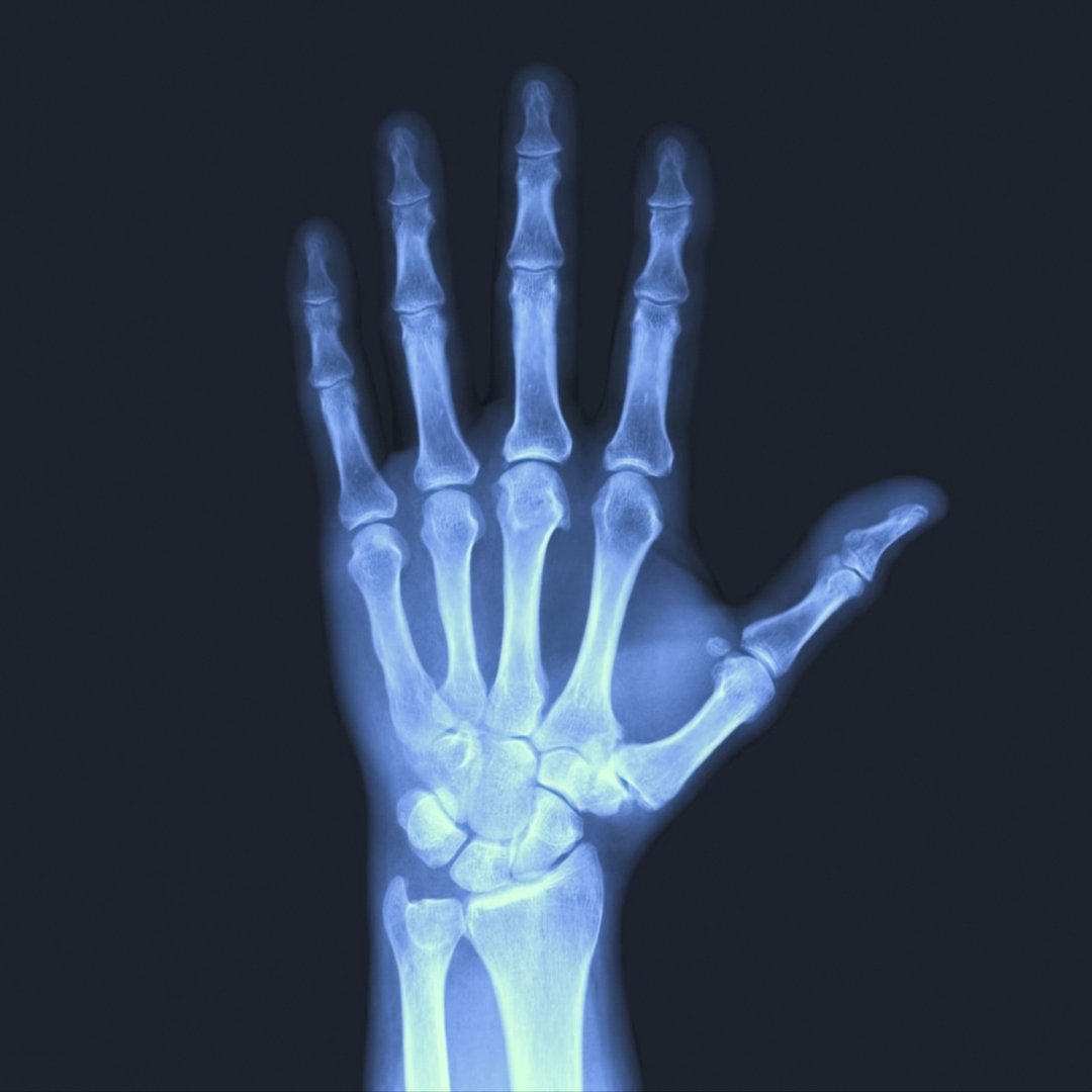 Цифровий рентген-апарат Philips MobileDiagnost M50 Цифровий рентген-апарат Philips MobileDiagnost M50