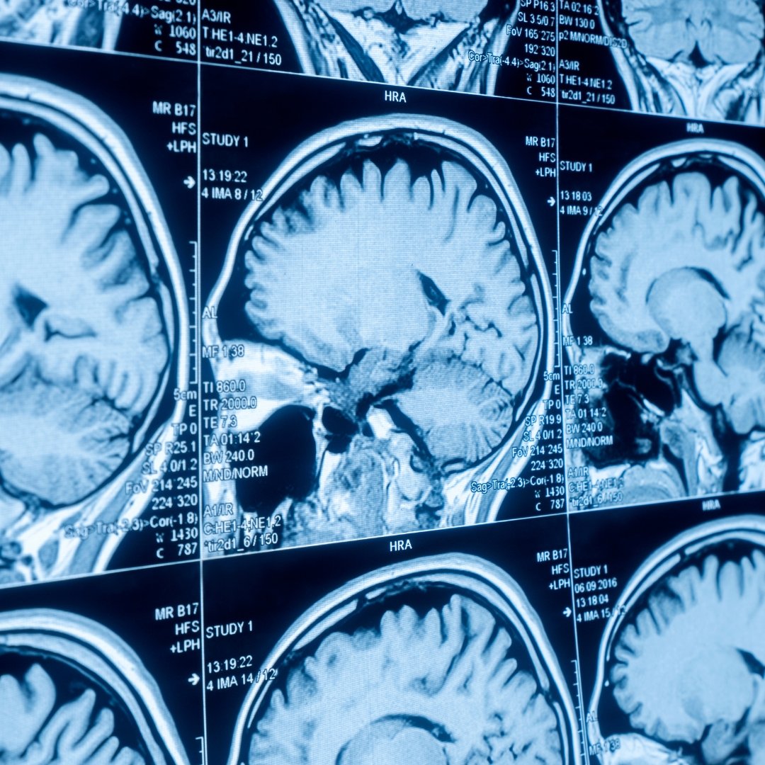 МРТ з седацією у Житомирі