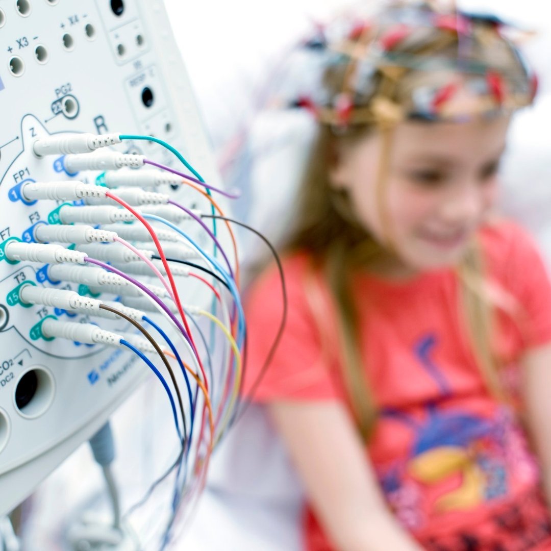 Електроенцефалографія у Житомирі
